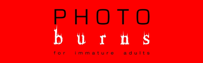 Photoburns for Immature Adults